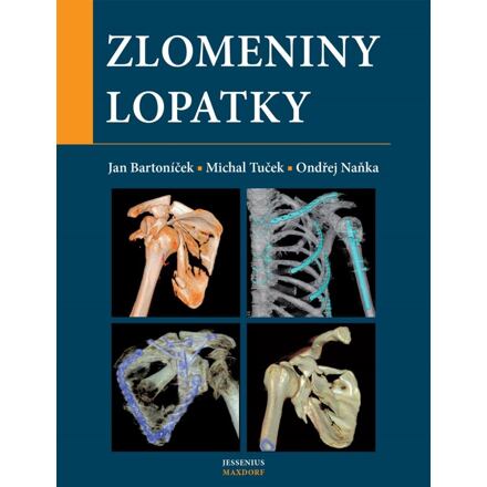 Zlomeniny lopatky