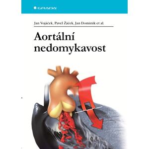 Aortální nedomykavost